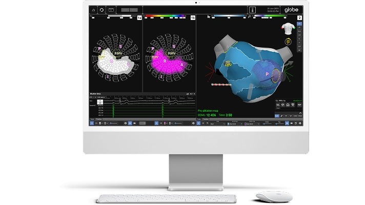 Image of Globe Software by Kardium